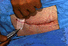 tape