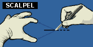scalpel grip