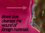 Blood flow pushing away debris