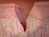 cut