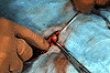 handtie