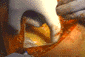 MPEG link