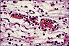 diapedis