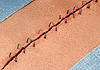 staples