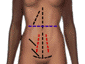 incis link